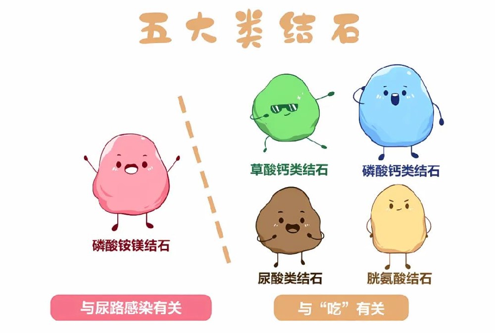 结石也分“门派”？成分不同，预防大不同！