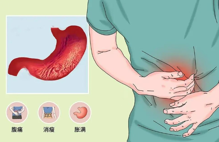 胃肠道也有“节后综合症”，这几个信号你中招了几个？