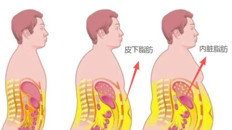别忽视腰围！它正悄悄 “偷走” 你的寿命
