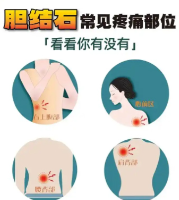 一个小石头也会导致“癌症”