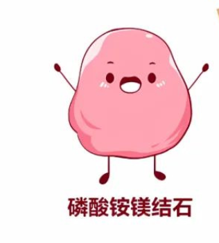 不同结石都有哪些“门派”？