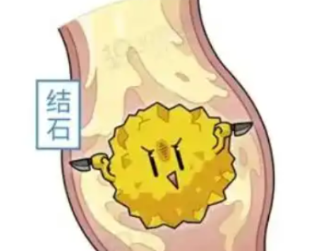 这份「避石指南」帮你安然度秋！