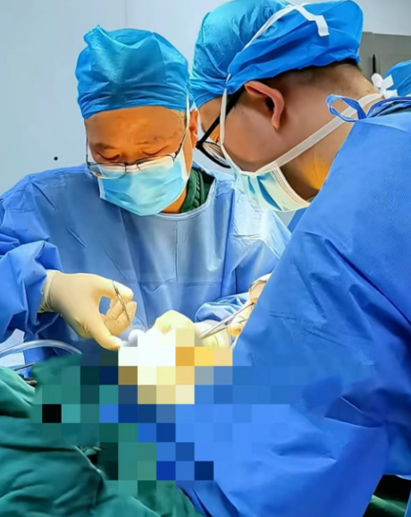 胆囊结石 “溜” 进胆总管？双镜联合微创术解难题